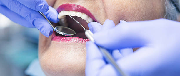 Best Broken or Cracked Tooth Emergency Dentist in Queens Gate, PA